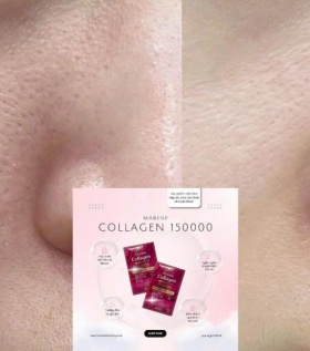 Collagen 15000mg Nhật Bản - Collagen tốt lành & tiết kiệm